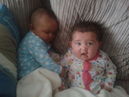 英國初のケース！肌と目の色が違う一卵性雙生児