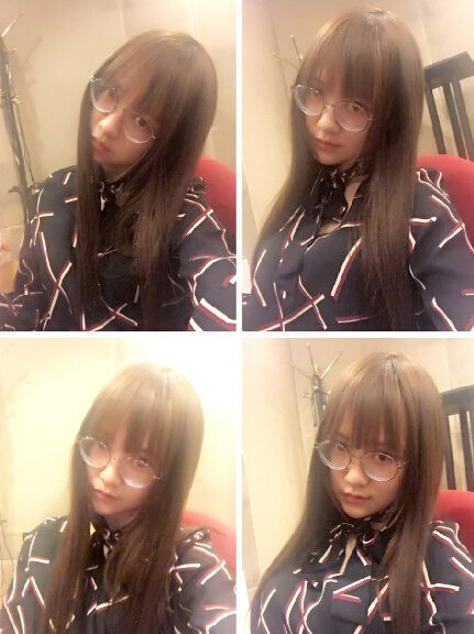 SNH48のメンバー唐安琪が大やけど　危険な狀態(tài)続く