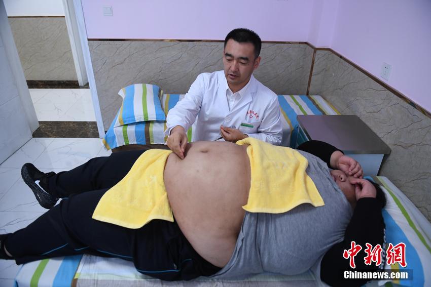 體重200キロの「95後」の女性、ダイエットに踏み切る