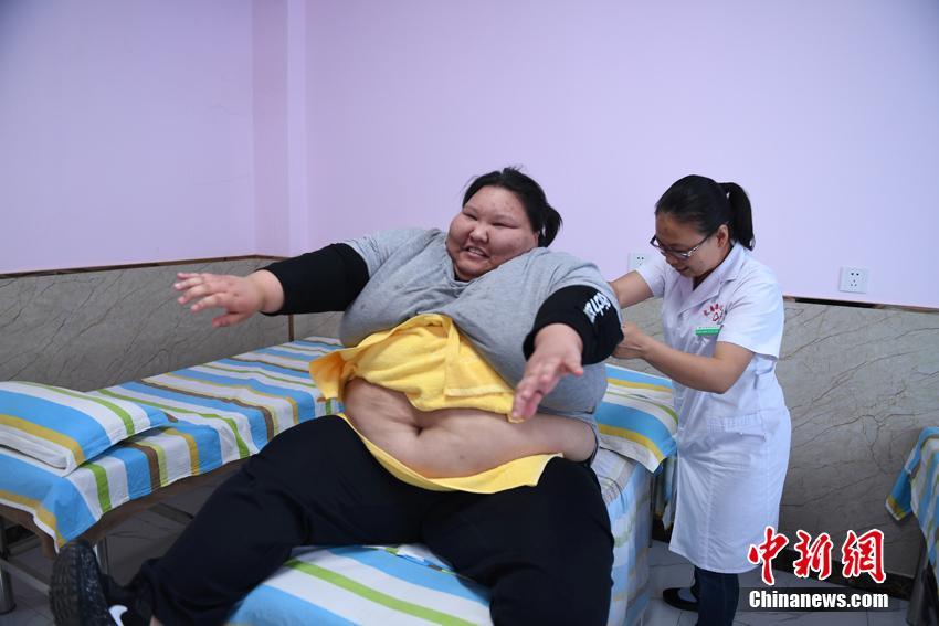 體重200キロの「95後」の女性、ダイエットに踏み切る