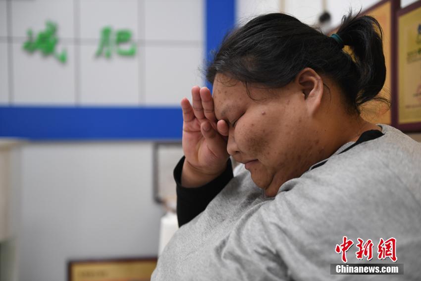 體重200キロの「95後」の女性、ダイエットに踏み切る