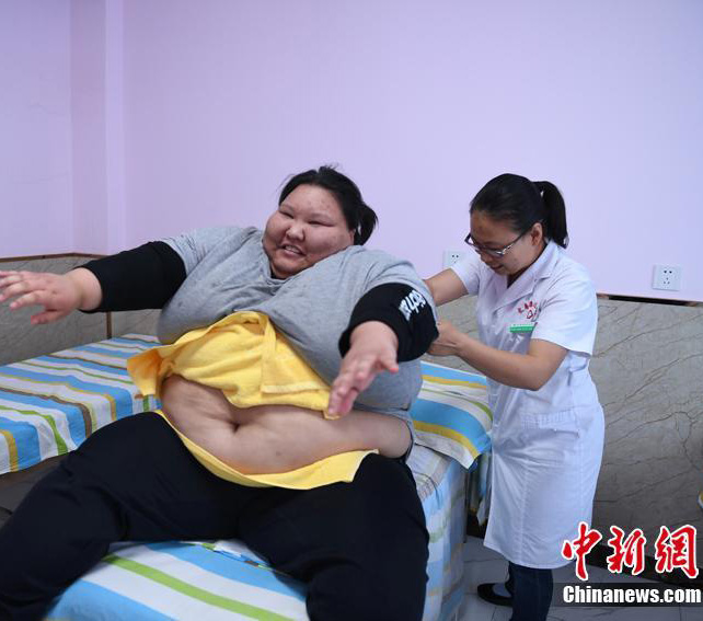 體重200キロの「95後」の女性、ダイエットに踏み切る