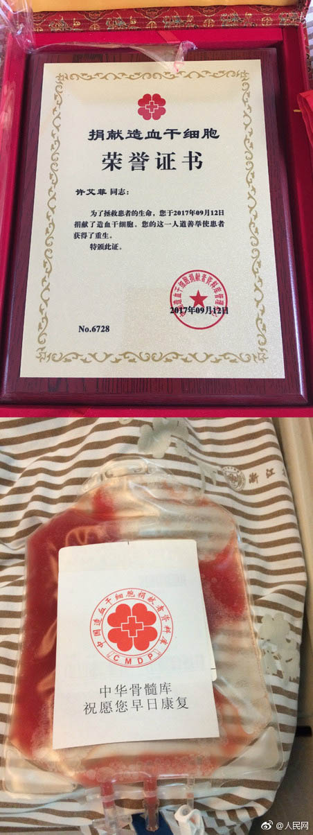 浙江女性が白血病の男の子に造血幹細(xì)胞を提供　腕が「ハチの巣」?fàn)顟B(tài)に