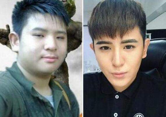 ルックスが原因で振られた男性、整形後の世界の変わりように感慨