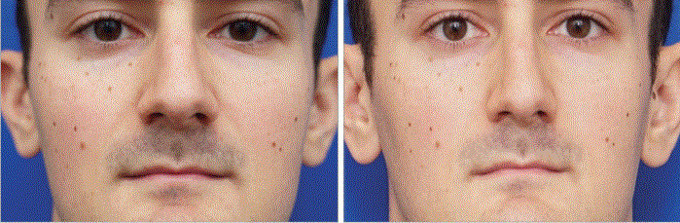 あなたは「自撮り」寫(xiě)真の出來(lái)栄えに満足している？