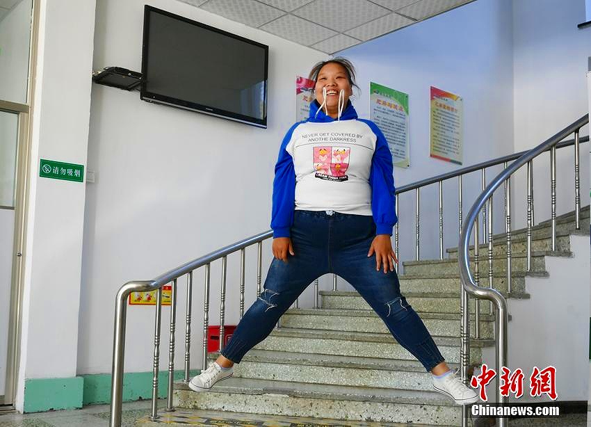 1年でなんと100キロの減量に成功した21歳女性