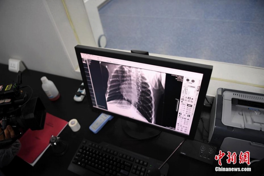 パンダの琴心と小核桃、野生化に向けて最後の健康診斷