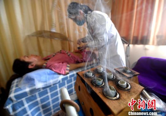伝統(tǒng)の「三九灸」が福建省の福州市民に大人気