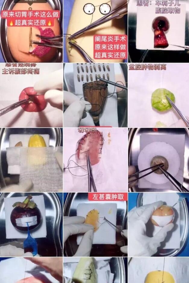 ネットで話題集める「フルーツドクター」　手術(shù)動(dòng)畫(huà)を作るその思いとは？