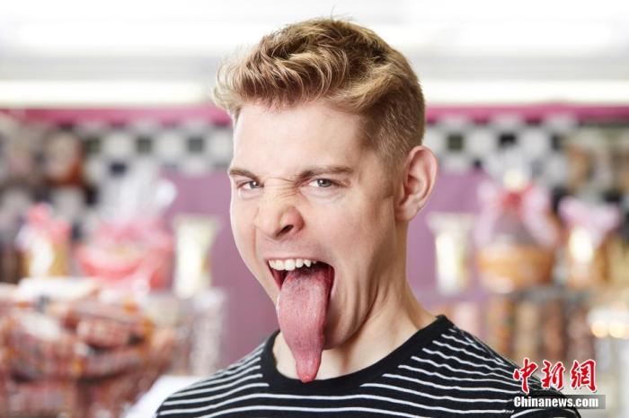 計(jì)測値10.1センチという「世界で最も長い舌」記録保持者である米カリフォルニア州のニック?ストーベールさん（24）。