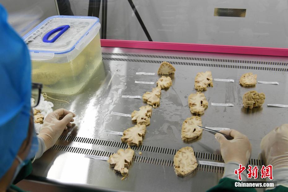 中國(guó)初のブレインバンク訪問(wèn) 人の脳の謎の解明目指す