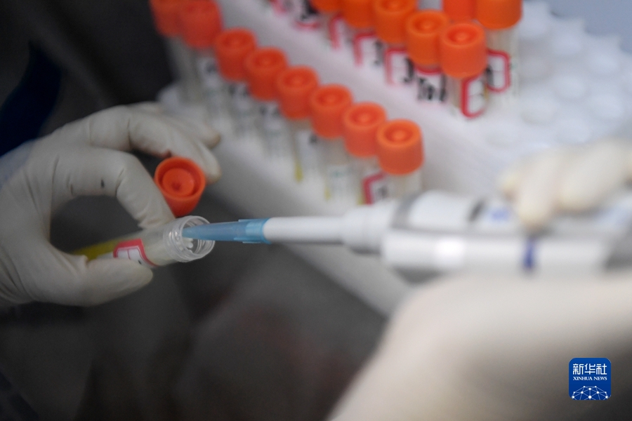 ウイルスとの「競(jìng)走」　PCR検査実験室を訪ねて