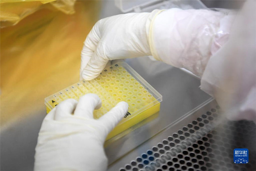 「ウイルスハンター」のエアドーム型実験室「猟鷹號(hào)」を訪ねて