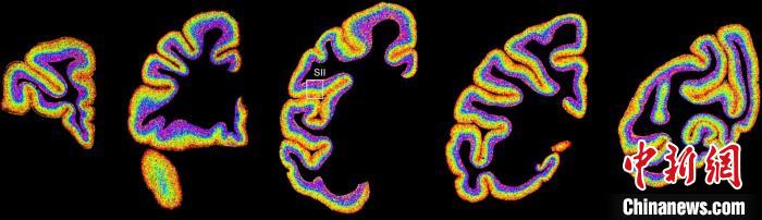 アカゲザルの脳における異なる種類の細(xì)胞の分布狀況。畫像提供は中國科學(xué)院脳科學(xué)?スマート技術(shù)卓越イノベーションセンター