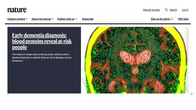 「ネイチャー」誌の同研究を重點的に推薦するページ。畫像提供は研究チーム。
