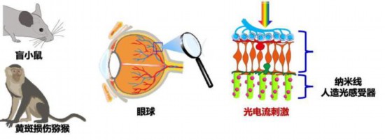 研究チームはアカゲザルの目に人工光受容體埋め込み手術(shù)を行い、埋め込みから54週間にわたり、安定性と生體適合性を保った（畫(huà)像提供?復(fù)旦大學(xué)附屬眼耳鼻喉科病院）。